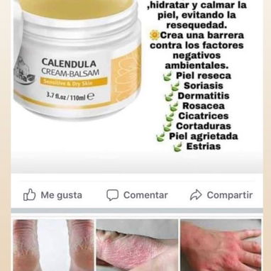Bálsamo de Caléndula Original 🌿 | Irritaciones, piel seca, acné, bebés | Entrega en La Habana - Img 116760193
