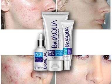 ✅✅ kit anti acne bioaqua profesional con crema, serum y limpiador anti acne completo skincare✅✅ - Img 40727104
