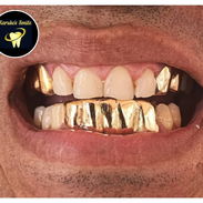✨💯Karuko Smiles 🤩✨Sonríe con estilo, Brilla con 🥇✨ Ponte pill@ 😁💪🏻 - Img 57074319