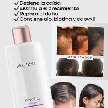 😩 ¿Se te está cayendo mucho el cabello o lo notas cada vez más débil y fino? - 2/3