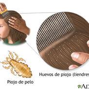TRATAMIENTO COMPLETO PARA PIOJOS - Img 57289369