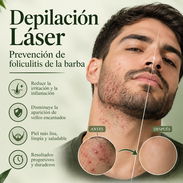 Prevención de foliculitis de la barba - Img 58208181