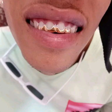 ✨🪙 J&A Sonríe con estilo✨, Brilla con oro✨tenemos oferta especial 😃 x el día de los padres 🤩  Realizo todo tipo de tr - Img 123133461