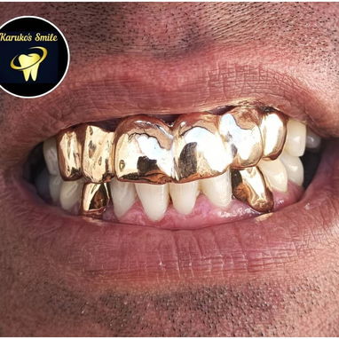 ✨💯Karuko Smiles 🤩✨Sonríe con estilo, Brilla con 🥇✨ Ponte pill@ 😁💪🏻 - 6/10