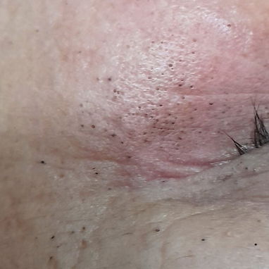 Masajes / limpieza de Espalda/ limpieza facial profunda / pedicura hidratante - Img 124909666