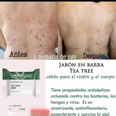 🌿 **JABÓN DE TEA TREE – LIMPIEZA PROFUNDA PARA PIEL GRASA Y CON ACNÉ** 🌿 - 2/2