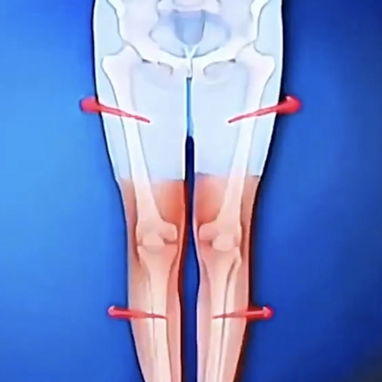 🚨 PLANTILLAS PARA EL PIE PLANO 🦶 🚨  FASCITIS PLANTAR💰 - 6/9