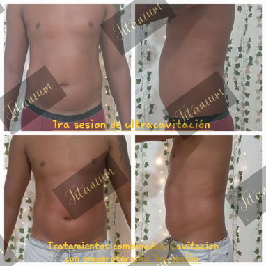 Eliminar grasa abdominal, quemador de grasa, eliminar flacidez, maderoterapia , masajes, grasa, bajar de peso - Img 112244912