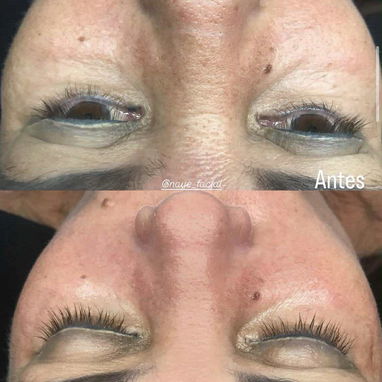 Tratamientos faciales - 2/5
