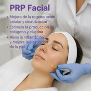 PRP Facial. Medicina Estética para tu eterna juventud - Img 56433095