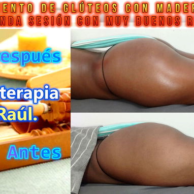 Masajista y Maderoterapeuta. En Spa Leydis brindamos múltiples servicios. Los esperamos. - Img 127881767