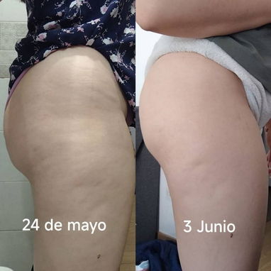 Gel para la flacidez y tonificar la piel - Img 112531993