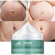 Crema para marcas de estiramiento para masaje corporal y reducción de cicatrices durante el embarazo - Img 57903290