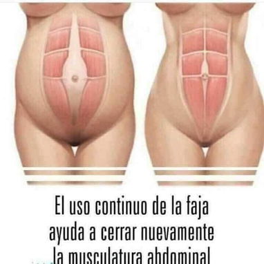 FAJA 3 VELCROS DE COMPRESIÓN - Img 103438429