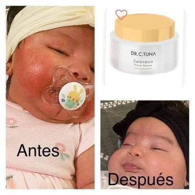 Crema de Caléndula de la marca Turca Farmasi cicatrizante, elimina manchas y marcas en la piel - Img 118813145