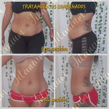 Reducción y bienestar corporal (Nfinitymkt) - Img 125838688