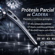 Prótesis parcial de cadera - Img 58114875
