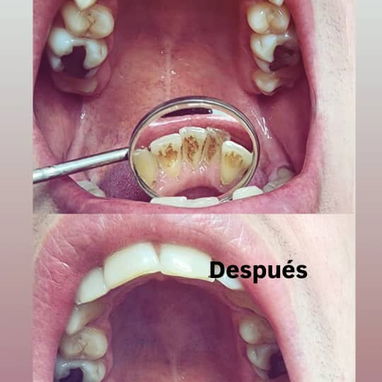 No se lo pierda , servicio de estética dental - Img 93032214
