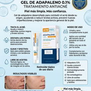Adapaleno para acné - Img 56009661