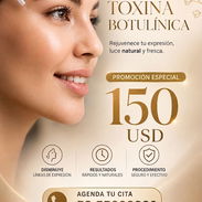 Aplicación de Botox --55098289 - Img 55392289