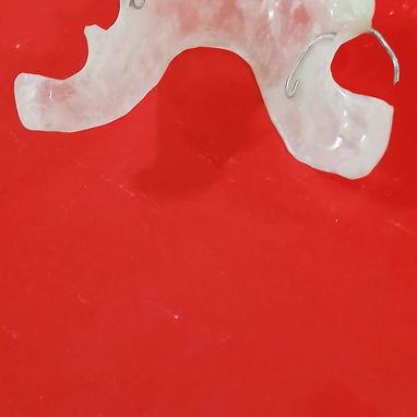 Prótesis Dental parciales y totales removible de acrílico - Img 125960801