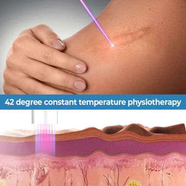 UNICO EN REVO➡️PLUMA PARA ELIMINAR CICATRICES CON FOTOTERAPIA UV - 2/3