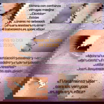 Tratamiento láser para verrugas y cicatrices