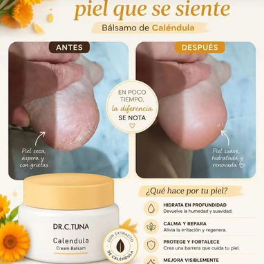 Bálsamo de Caléndula 🌼 de FARMASI. Ideal para hidratar la piel, tratar lesiones,piel sensible, psoriasis, manchas.. - 3/5