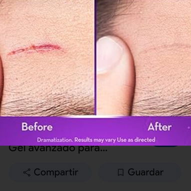 Gel para Cicatrices Cicatricure - 10/10