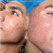 🔥 ¡CAMBIA TU ROSTRO, ELEVA TU BELLEZA HOY! 🔥 ¿Lista para verte más joven, radiante y segura desde la primera sesión? - Img 55433425