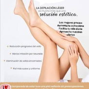 Tratamiento laser para eliminar el vello permanente - Img 57266187