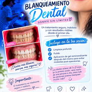 ¡¡Blanqueamiento dental!! Sonríe sin límites🫶🏻🦷 - Img 57375706