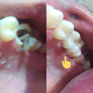 Diseño d sonrisa - 5/10
