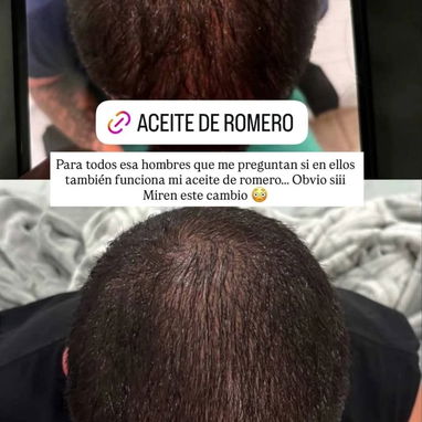 Aceite de romero de la Influencer Amanda Camaraza - Img 122127964