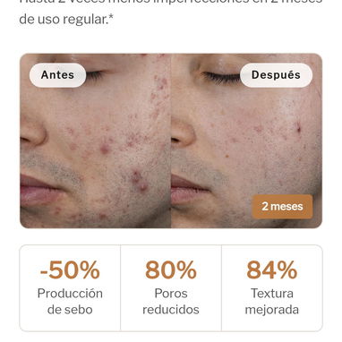 Novexpert Serum Booster Trio Zinc 30 mL (Pieles Grasas y Acné) - Img 124692035