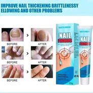 CREMA PREVENTIVA PARA UÑAS CON ONICOMICOSIS 1900$ - Img 55127561