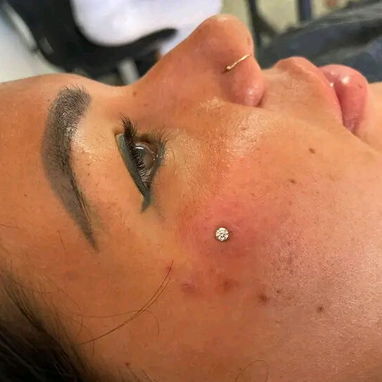 Perforaciones Kary/ Piercing Microdermales/ Sharoski - 3/7