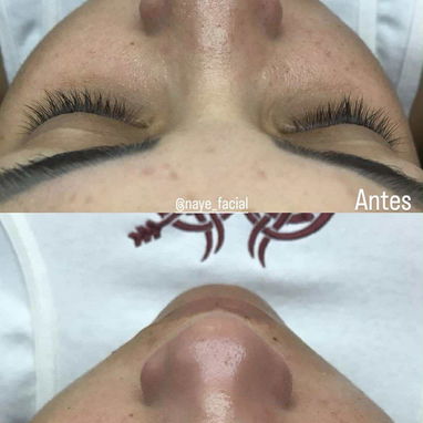 Tratamientos faciales - 3/5
