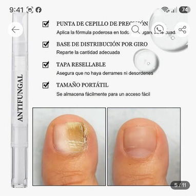 Fuera Uñas Enfermas en Manos y Pies, Lápiz Seralia Anti Hongos - 5/8