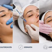 Electrocauterizacion. Dermapen. Limpieza facial. Consulta dermatológica - Img 55585074