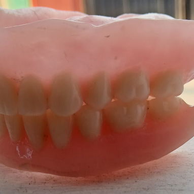 Prótesis Dental parciales y totales removible de acrílico - Img 125960909