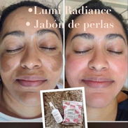 🌟DÚO ACLARADOR🌟 SÉRUM LUMI RADIANCE+ JABÓN DE PERLAS 🌟 - Img 55827872