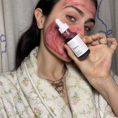 Peeling The Ordinary exfoliante corrige imperfecciones gracias a sus compuestos activos AHA30% Y BHA2% - 3/3