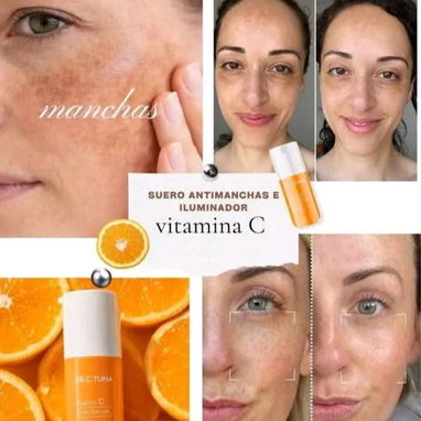 🍊SERUM DE VITAMINA C🍊 ANTIMANCHAS E ILUMINADOR - 2/4