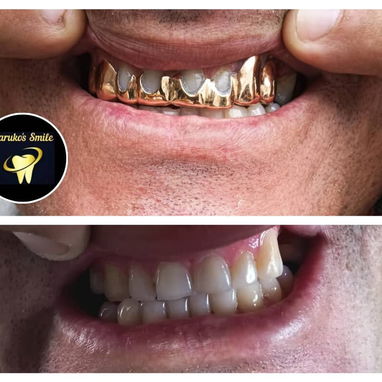 ✨💯Karuko Smiles 🤩✨Sonríe con estilo, Brilla con 🥇✨ Ponte pill@ 😁💪🏻 - 2/10