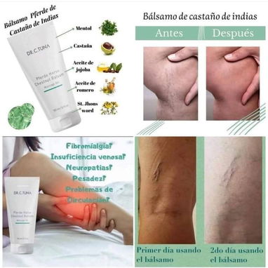 ¿Piernas hinchadas, cansadas o varicosas? 🌱✨ - Img 122301067