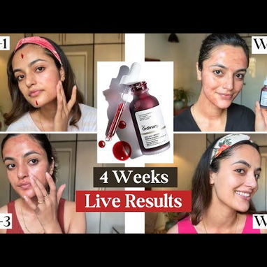 Peeling The Ordinary exfoliante corrige imperfecciones gracias a sus compuestos activos AHA30% Y BHA2% - 2/3