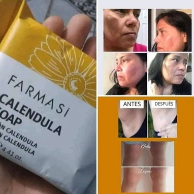Jabón de Caléndula 🌼 de FARMASI.Ideal para pieles secas y sensibles. - 4/4