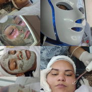 Limpieza facial profunda con Aparatologia - Img 55709418