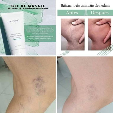 ⚡Gel para dolores articulares y musculares de castaña de indias⚡ - 3/3
